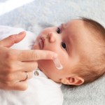 baby with Eczema